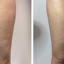 Tighten Body Bar