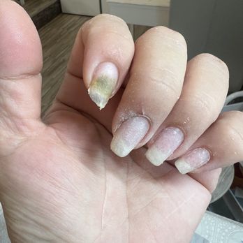 Tina Nail - Infection - Nail Salons Near Me - Los Angeles, California