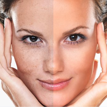 Belle Aesthetics - Weight Loss Centers Near Me - Beaumont, Texas Belle Aesthetics - Weight Loss Centers Near Me - Beaumont, Texas