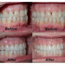 Westside Family Dental