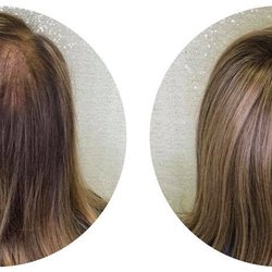 Haus of Hair - Topper Before & After
