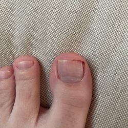 AJ Nails - Too right and lower left of big toenail was bleeding.