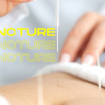 Harmony Chiropractic Clinic - Acupuncture Kelowna - Chiropractors Near Me - Kelowna, British Columbia