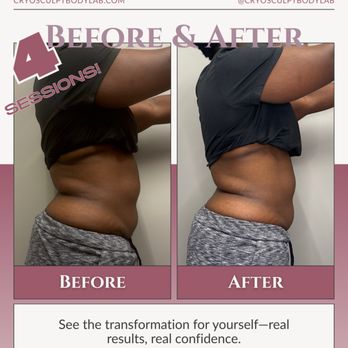 CryoSculpt Body Lab - Body Contouring Near Me - Orlando, Florida CryoSculpt Body Lab - Body Contouring Near Me - Orlando, Florida