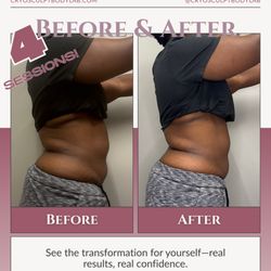 CryoSculpt Body Lab