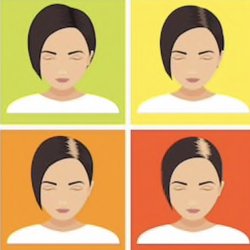 ScalpGod SMP & Hair Restoration - Common Female Pattern Baldness