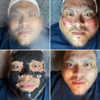 Mirame Skin Treatments by null