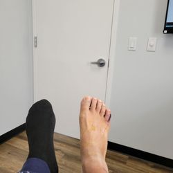 Suffolk Foot and Ankle - Post surgery check up