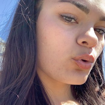 Skin by Fatima - 3 months after!!! - Skin Care Near Me