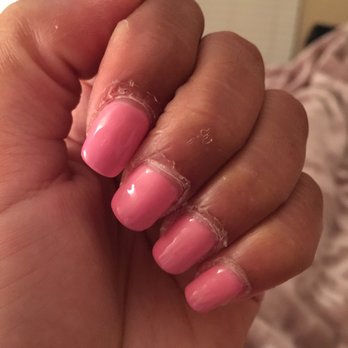 Famous Nails - The nails weren't done here but this is how my cuticles look now. They always peel and this was never a problem before Vu did my nails. - Nail Salons Near Me - Myrtle Beach, South Carolina