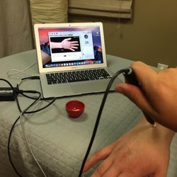 Merriam Chiropractic Center - The AcuGraph Digital Meridian Imaging system is a computerized tool used to analyze the energetic status of the acupuncture meridians.