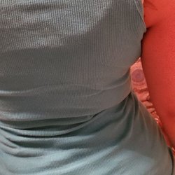 A Body By Design - Before body sculpting