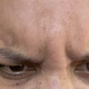 Liquivida - I shouldn't be able to make this face. - Medical Spas Near Me - Fort Lauderdale, Florida Liquivida - I shouldn't be able to make this face. - Medical Spas Near Me - Fort Lauderdale, Florida