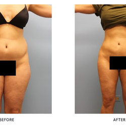 Liposuction and Cosmetic Surgery Institute