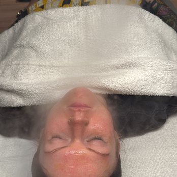 INNER SOL ESTHETICS - Prepping for Extractions - Day Spas Near Me - Indianapolis, Indiana INNER SOL ESTHETICS - Prepping for Extractions - Day Spas Near Me - Indianapolis, Indiana