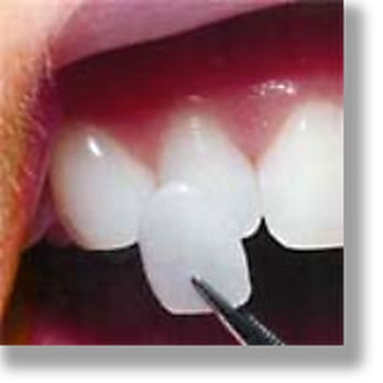 Kirk N Hampton, DDS - Oral Surgeons Near Me - Dallas, Texas