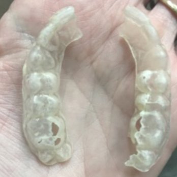 Orange Coast Orthodontics - Orthodontists Near Me - Laguna Hills, California Orange Coast Orthodontics - Orthodontists Near Me - Laguna Hills, California