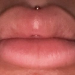 Piercings By Bio Hazard - Medusa piercing exit point incorrectly placed; back of jewelry not positioned inside the mouth.