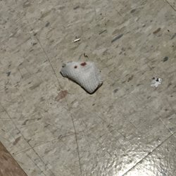UM Upper Chesapeake Medical Center - Bloody gauze