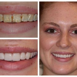 Harmony Dental Care - Kalil Abide - Smile Makeover