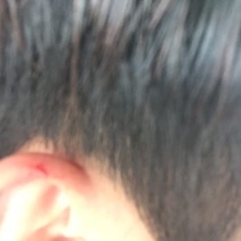 The Barbers - Corvallis - So that was the outcome on my right ear. - Barbers Near Me - Corvallis, Oregon