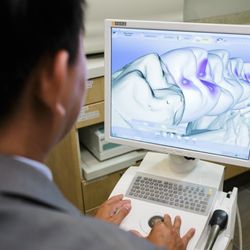Galleria Smile - Sugar Land - Cerec Machine in process.
