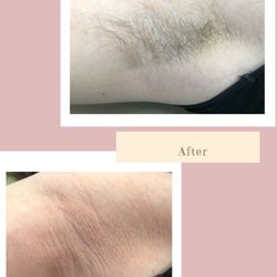 Waxtopia - Female Underarm Wax