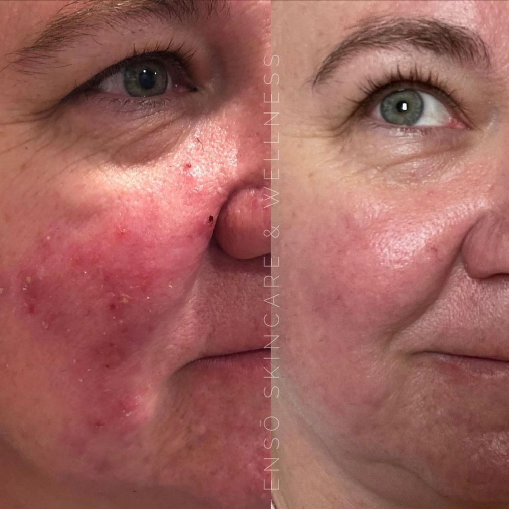 Ensō Skincare & Wellness Logo