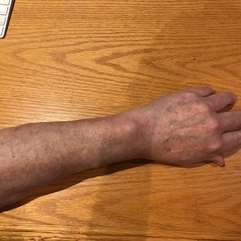 Osborne Village Ink - Left Forearm - Tattoo Near Me - Winnipeg, Manitoba Osborne Village Ink - Left Forearm - Tattoo Near Me - Winnipeg, Manitoba