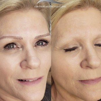 Contour Aesthetics Clinic - Before and after! - Permanent Makeup Near Me - Largo, Florida