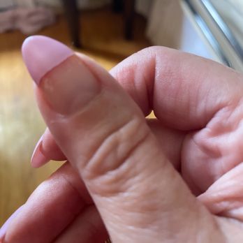Elite Nails Lounge - another example of the poor job of the manicurist at Elite Nail Salon - peeled off within two weeks - Nail Salons Near Me - Louisville, Kentucky