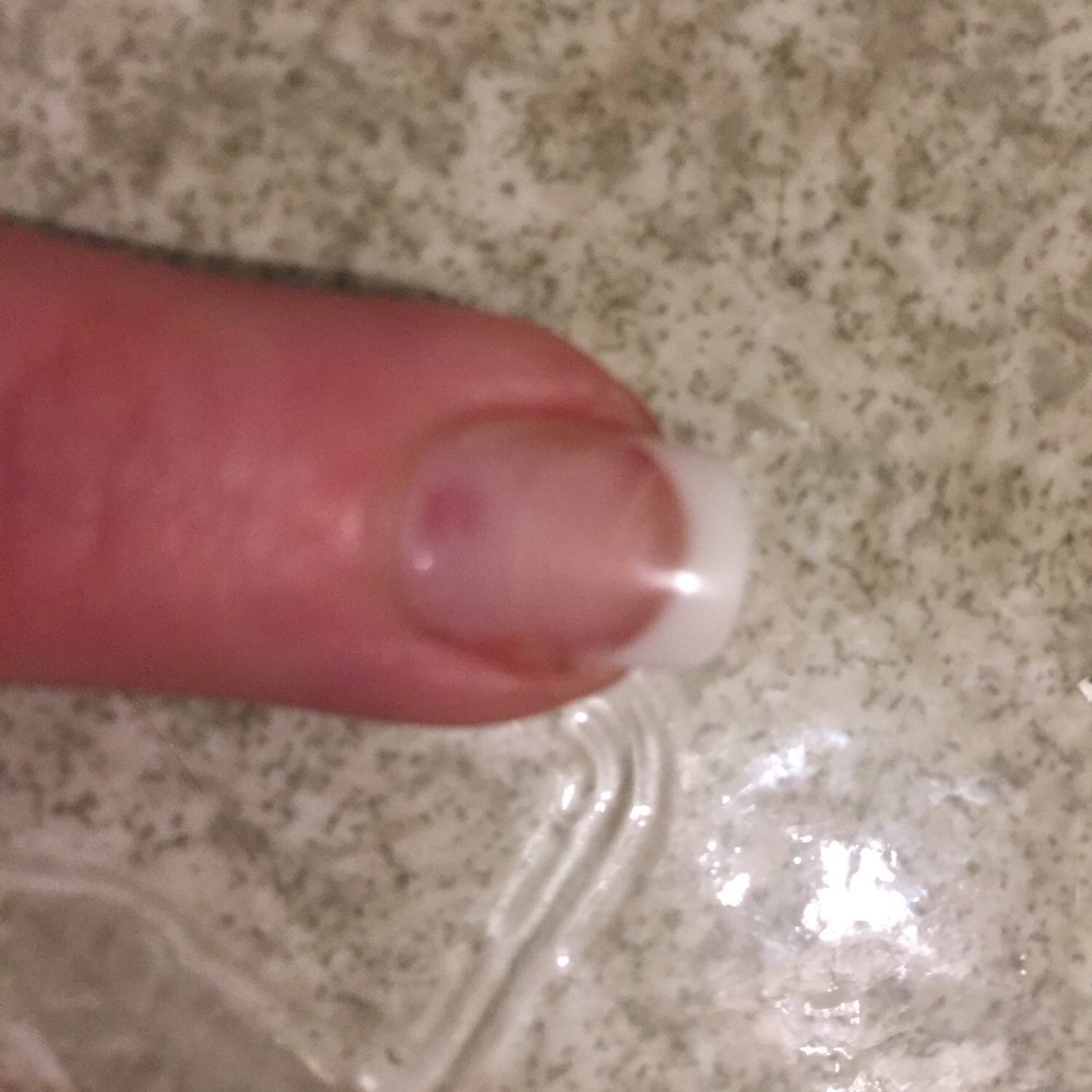 MD Nails - This is the healthiest looking one sorry embarrassed to show the rest do not go to this shop!!! - Nail Salons Near Me - Lynnwood, Washington MD Nails - This is the healthiest looking one sorry embarrassed to show the rest do not go to this shop!!! - Nail Salons Near Me - Lynnwood, Washington