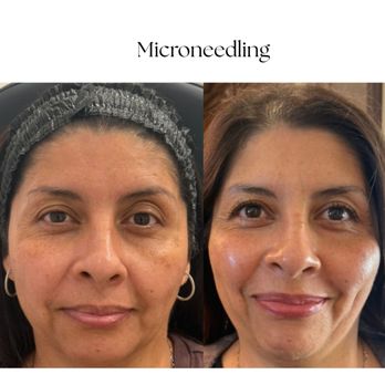 Skin Gratitude - Medical Spas Near Me - Brea, California Skin Gratitude - Medical Spas Near Me - Brea, California
