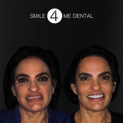 Smile 4 Me Dental - Smile Transformation - Clermont, FL