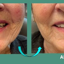 Smile Prosthetics