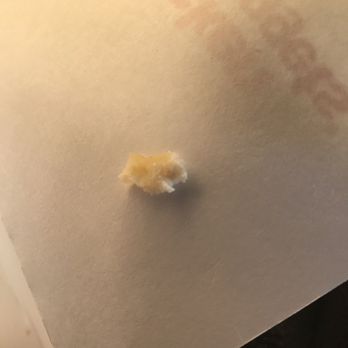 McDonald's - Ordered on uber eats. Took 15mins which is great. But nuggets came stale and there was this weird cartilage(see picture). - Fast Food Near Me - Vaudreuil-Dorion, Quebec McDonald's - Ordered on uber eats. Took 15mins which is great. But nuggets came stale and there was this weird cartilage(see picture). - Fast Food Near Me - Vaudreuil-Dorion, Quebec