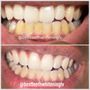 Photo of Best Teeth Whitening Las Vegas