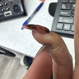 Skin files and really thick nails