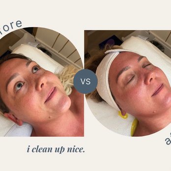 Du Method - Skin Care Near Me - Brooklyn, New York Du Method - Skin Care Near Me - Brooklyn, New York