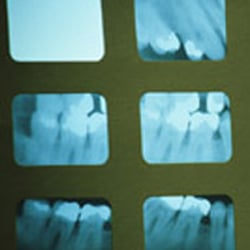 Cossich Family Dentistry - Oral Surgery in Covington, LA