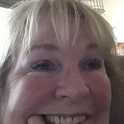 Sotack Maryjean DDS - My extra large canine tooth