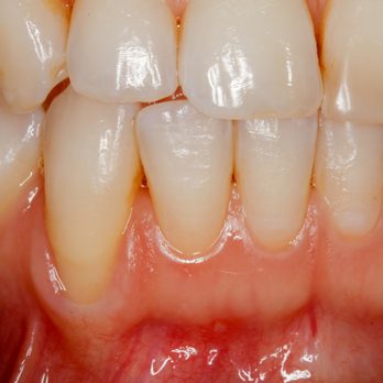 David S Kao, DDS - Periodontists Near Me - Los Angeles, California David S Kao, DDS - Periodontists Near Me - Los Angeles, California