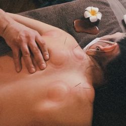 Zen Garden Massage & Spa - Tui Na massage with acupuncture