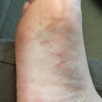 Nails Boutique & Spa - Scratches on my other foot. - Nail Salons Near Me - Oakville, Ontario Nails Boutique & Spa - Scratches on my other foot. - Nail Salons Near Me - Oakville, Ontario