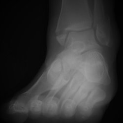 Zwanger-Pesiri Radiology