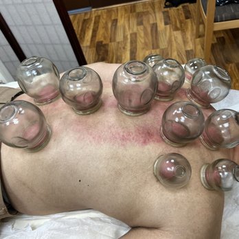 David Di Acupuncture - Acupuncture Near Me - Los Angeles, California David Di Acupuncture - Acupuncture Near Me - Los Angeles, California