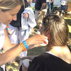 Scarsdale Acupuncture - Acupuncture seeds applied at festival