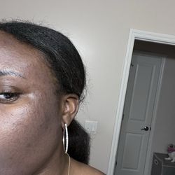Charming Skin Care - White cast on my face after the facial