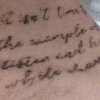 Removery Tattoo Removal & Fading - Result after Removery defaulted on agreement. - Tattoo Removal Near Me - Boston, Massachusetts Removery Tattoo Removal & Fading - Result after Removery defaulted on agreement. - Tattoo Removal Near Me - Boston, Massachusetts