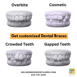 Bolingbrook Dental Care - #bolingbrookdentalcare #dentist